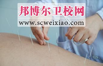 針灸治療注意事項(xiàng)有哪些