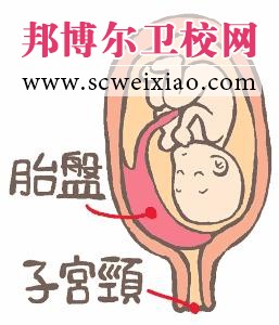 前置胎盤概念