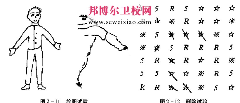 半側(cè)空間失認(rèn)癥