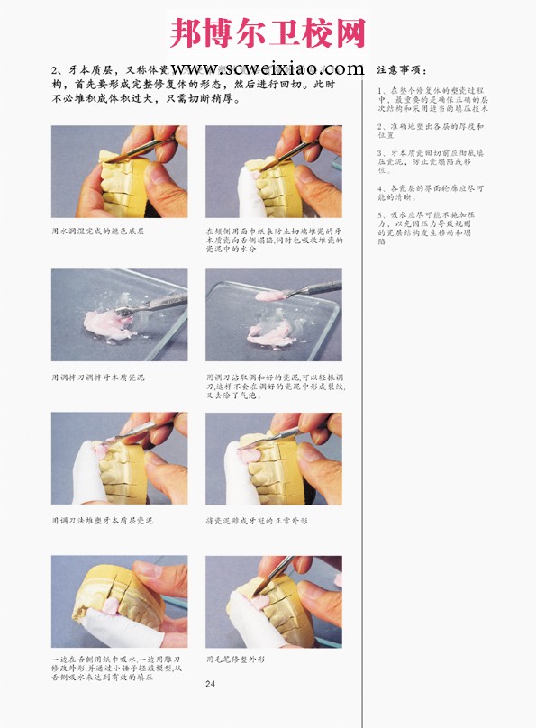 固定義齒的制作步驟